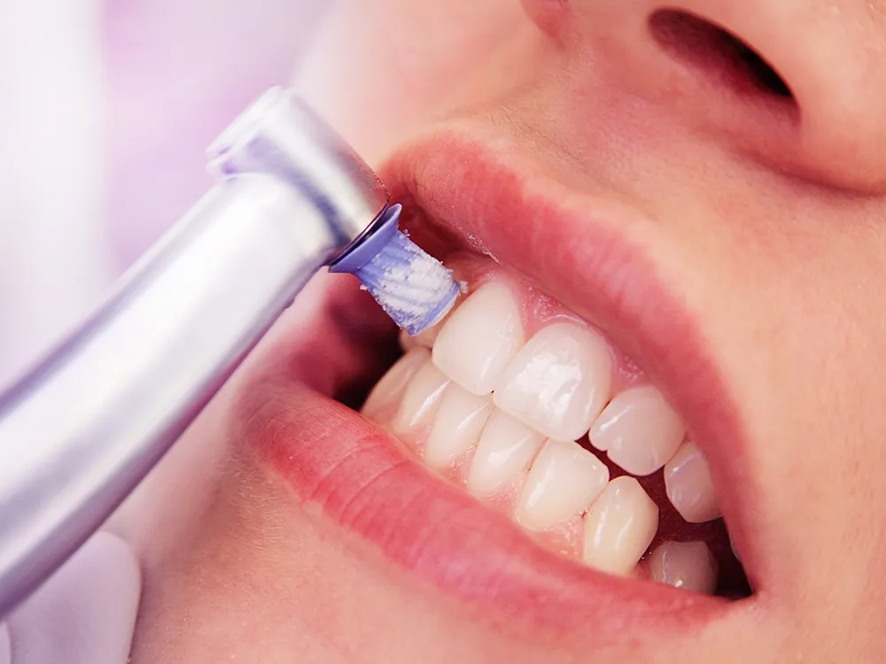 Professionelle Zahnreinigung - Zahnmedizin Achental