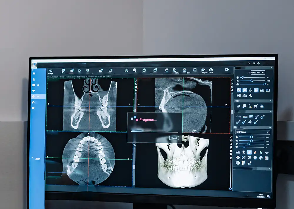 3D-Diagnostik (DVT)